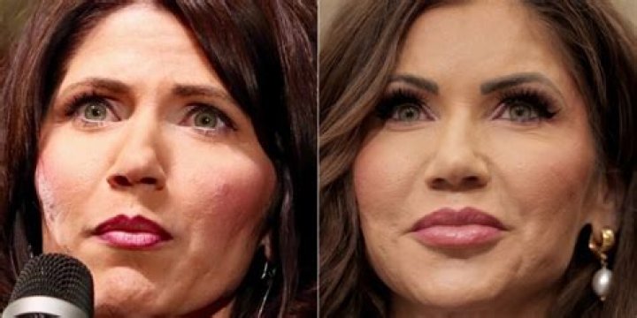 Did Kelly Reilly Get Lips Surgery? Before And After Photos