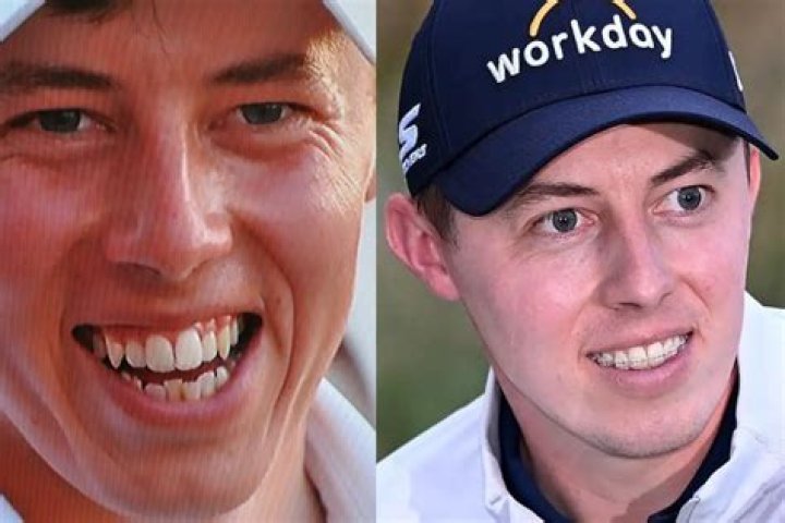 Did Matt Fitzpatrick Get Braces? More Details On Why The Golfer Teeth Looks So Different