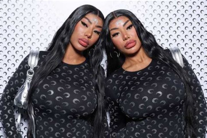 Siangie Twins Before And After Surgery, HipHop Duo Releases “Million Stars” Song