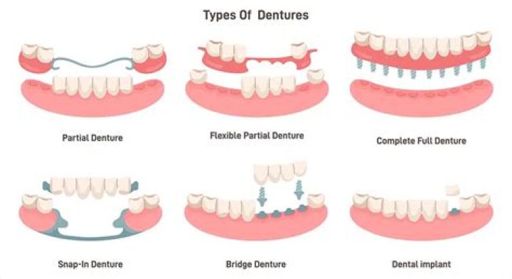 What Does Nancy Pelosi Move Her Mouth So Much? Teeth Dentures and Movement Explained